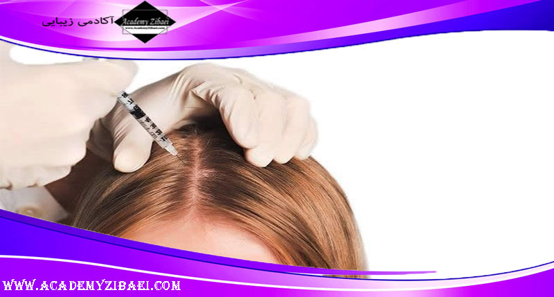 روش مزوتراپی مو چیست؟